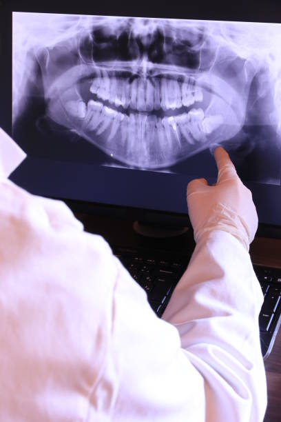 Best Emergency Dentist for Knocked-Out Tooth in Corinth, MS