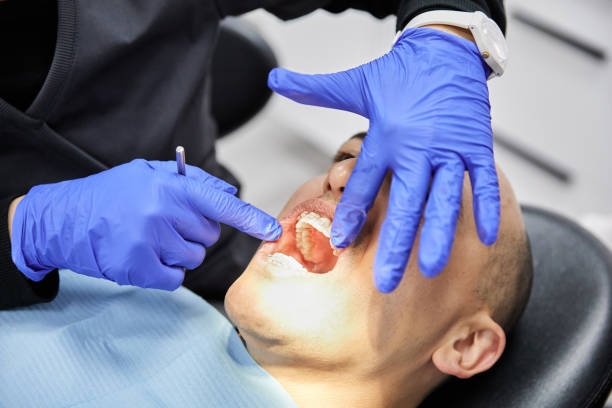 Best Emergency Dentist for Lost Fillings or Crowns in Corinth, MS